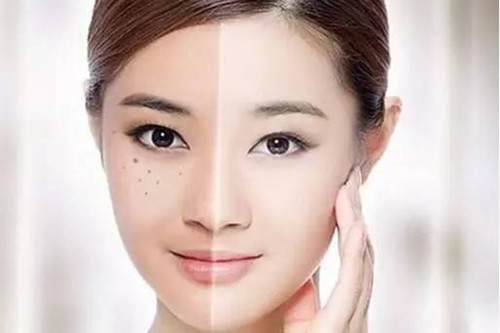 不再做自卑的“女斑长”,最好的淡斑教程来了!-源自护肤官网-专业指导敏感肌肤