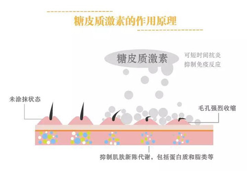 科学解析敏感肌肤和激素脸的成因，了解肌肤屏障
