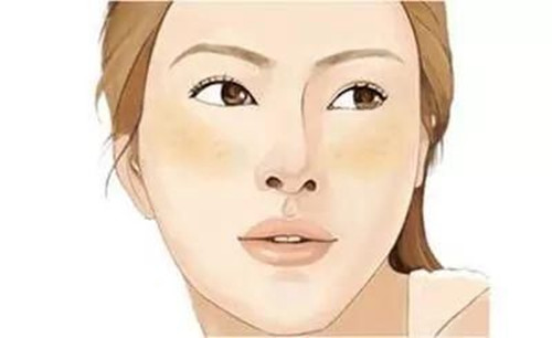 什么是红血丝肌肤？如何分辨以及日常如何防范