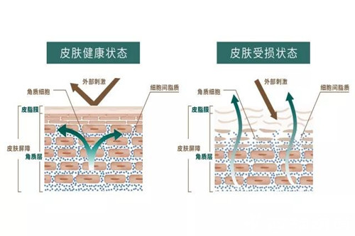 换季的时候街上的红血丝女孩多了起来，什么原因导致的？