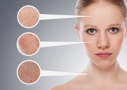 敏感肌肤用激光祛斑效果好吗？出现反黑如何应对？