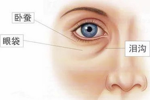 泪沟看起来憔悴又显老，有什么办法解决吗？