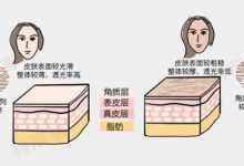 什么是角质代谢障碍?敏感肌有角质代谢障碍怎么办?-源自护肤官网-专业指导敏感肌肤