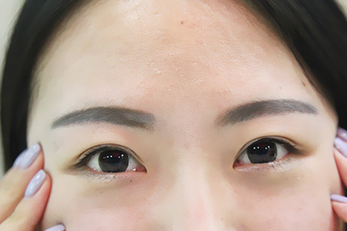干敏肌为什么眉心也会长痘痘？源自护肤答疑时间