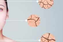皮肤敏感脱皮怎么办?敏感皮肤脱皮用什么方法修护?-源自护肤官网-专业指导敏感肌肤